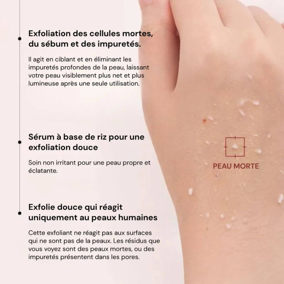 Peel Shot : Fini les points noirs, place à la peau nette.