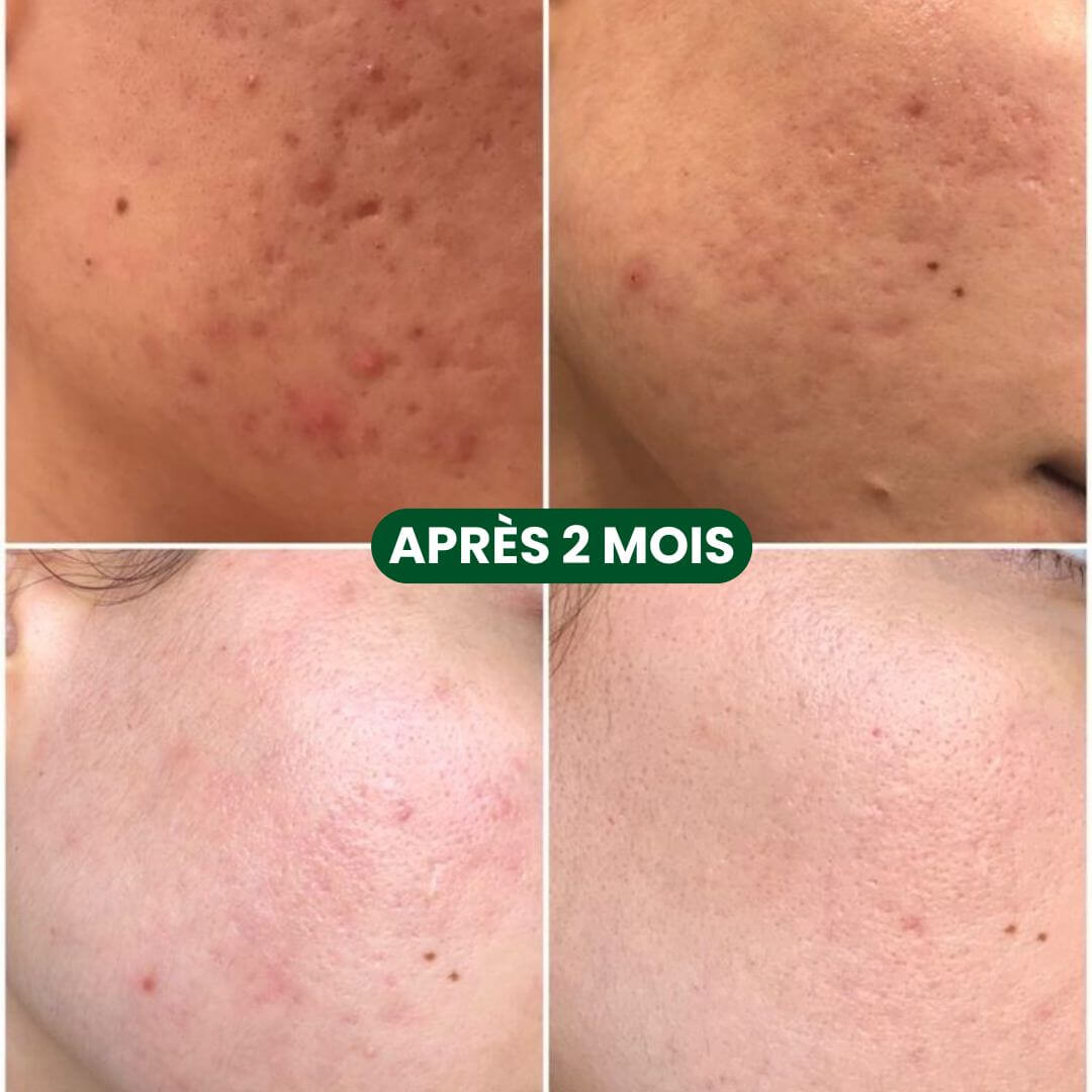 Masque Bulles Purifiant au Basilic Sacré