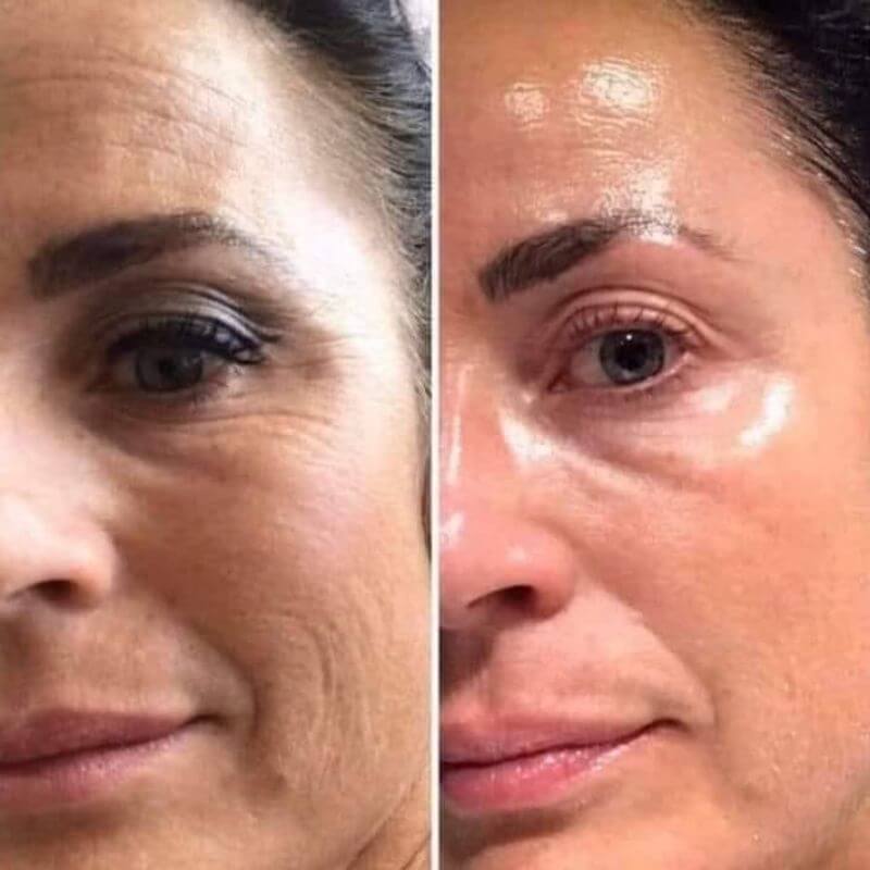 Avant et après Nuvea