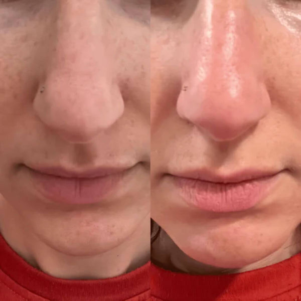 Témoignage client