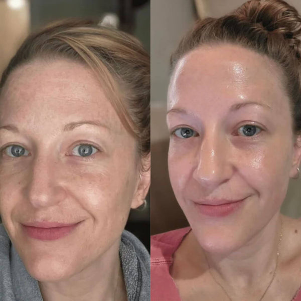 Témoignage client