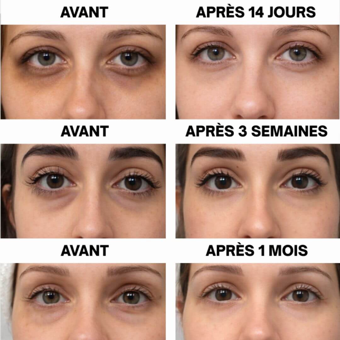 Patchs Hydrogel Peptide & Collagène