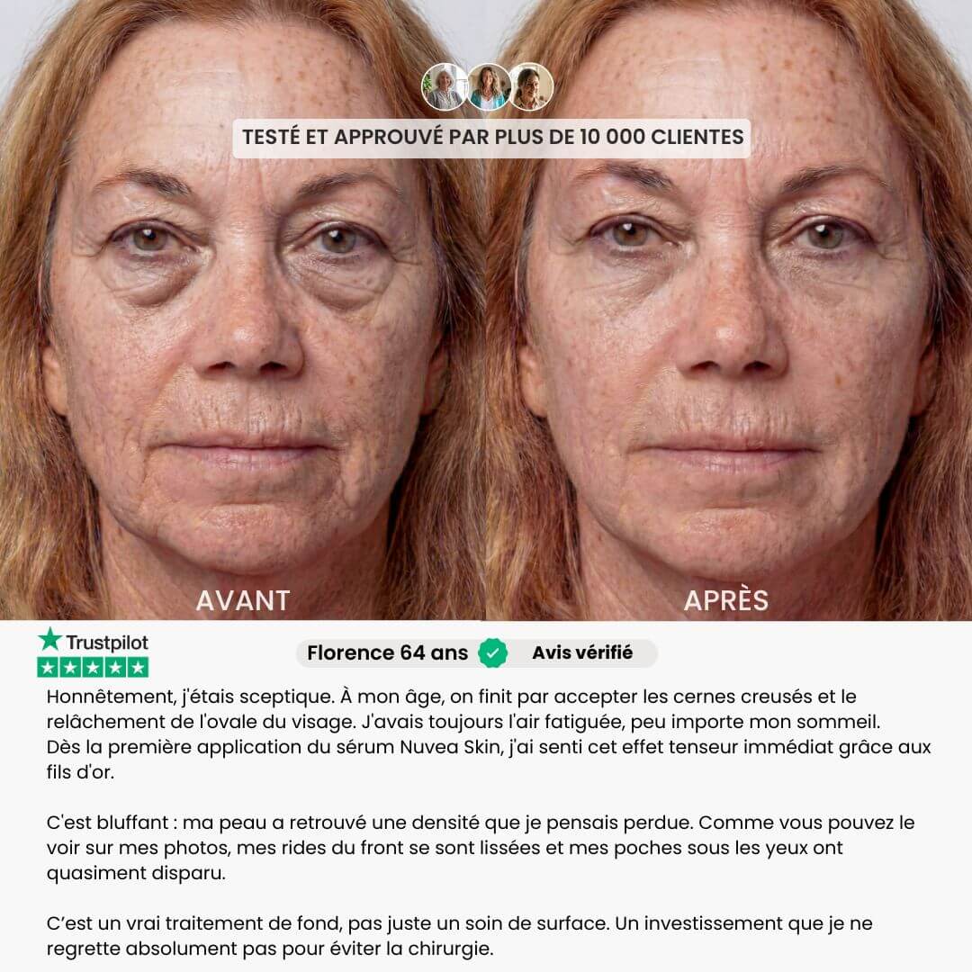 Nuvea Lifting Gold