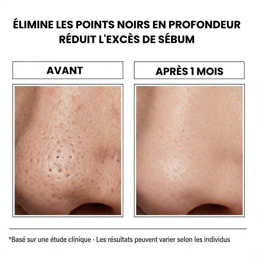 Masque Bulles Purifiant au Basilic Sacré